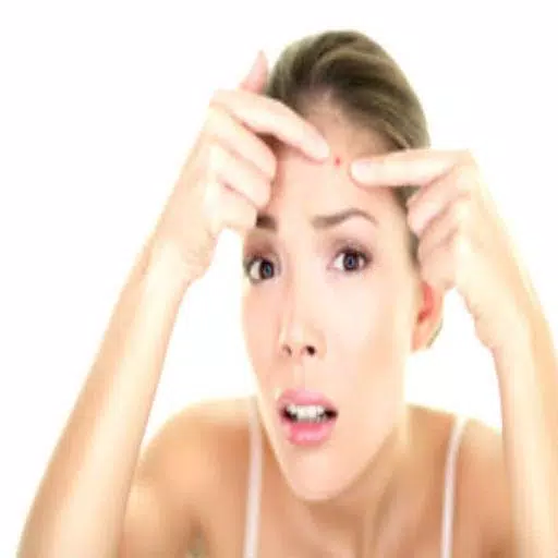 Get Rid of Acne  (Guide) Capture d'écran 1