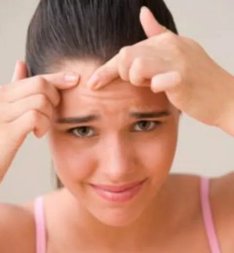 guide to Get rid of Acne Captura de pantalla 1